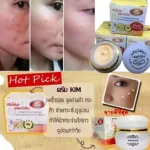 Kim হোয়াইটেনিং ক্রিম White 20gm