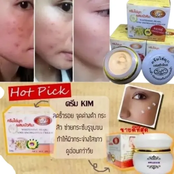 Kim হোয়াইটেনিং ক্রিম White 20gm