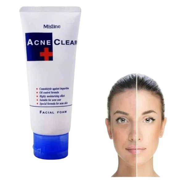 Acne Clear Plus ফেস ওয়াশ