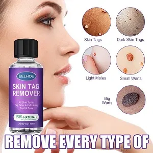 আঁচিল রিমুভার সিরাম 10ML