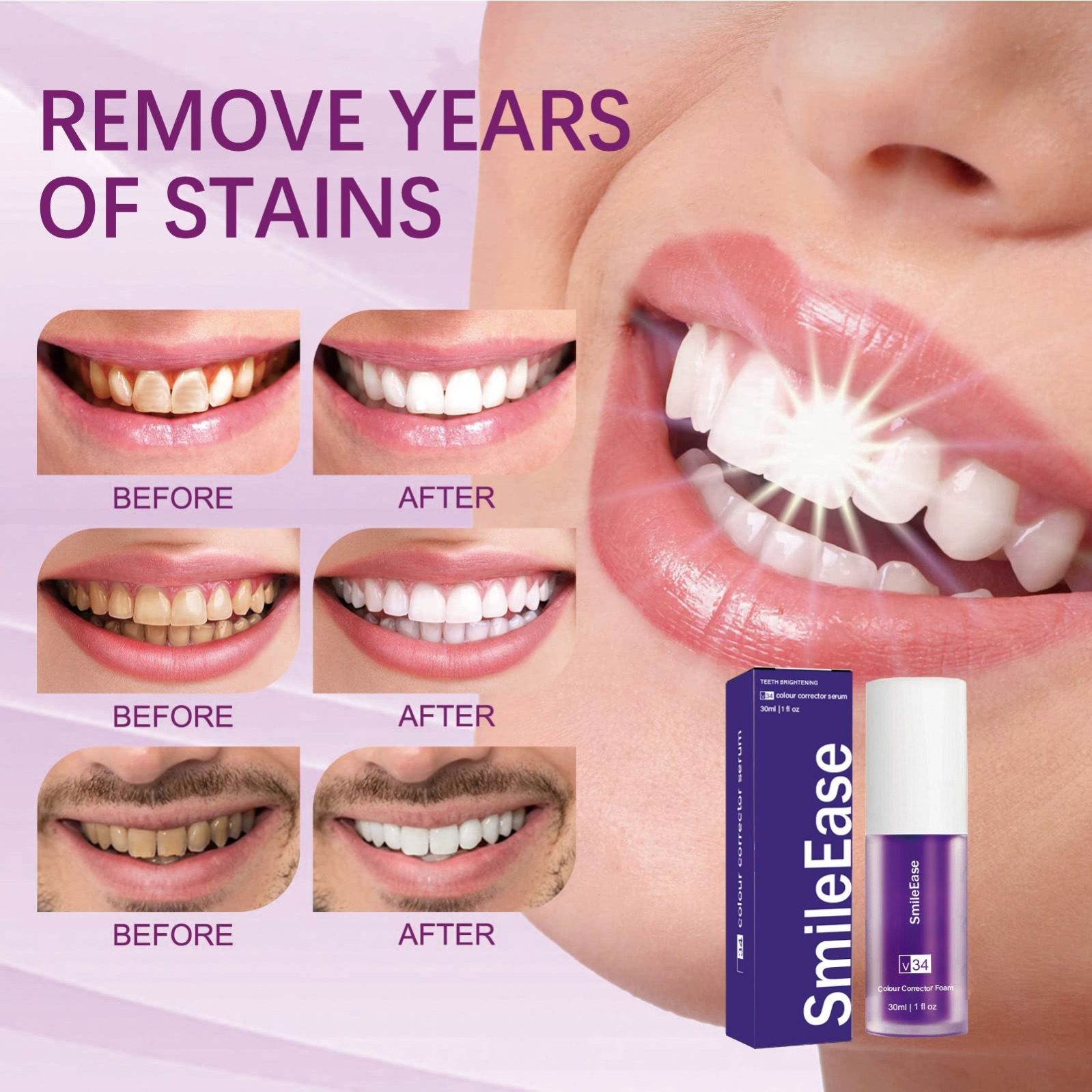 Hismile V34 কালার কারেক্টর সিরাম, দাঁতের জন্য