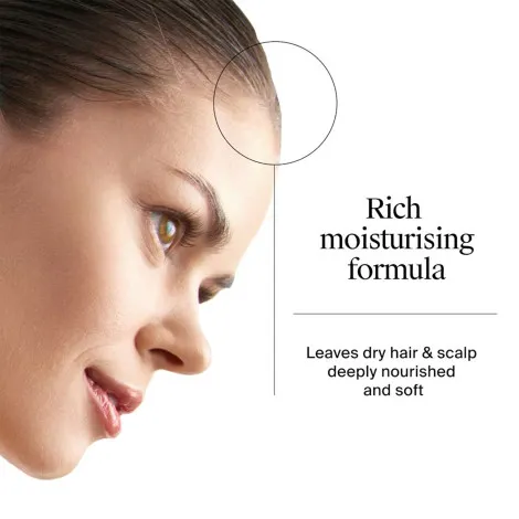 Neutrogena T/Gel অ্যান্টি-ড্যানড্রাফ ড্রাই স্ক্যাল্প শ্যাম্পু 250ml