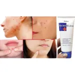 Acne Clear Plus ফেস ওয়াশ