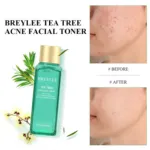 Breylee Tea Tree Acne ফেসিয়াল টোনার 100ml