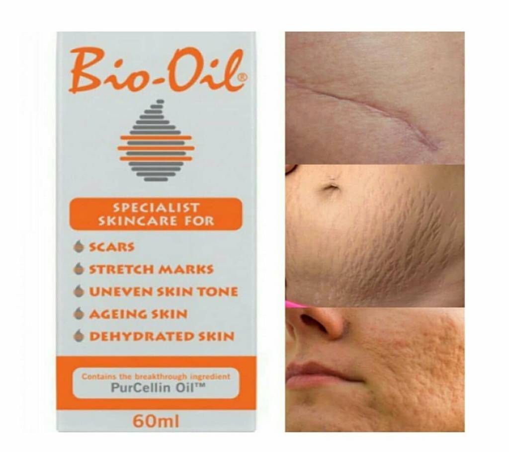 Bio-Oil For Women- Pregnancy Stretch Marks, Dark Elbows, Dark Knees, Dry Hand, Dark Neck, Acne Scars Remover (60ml)